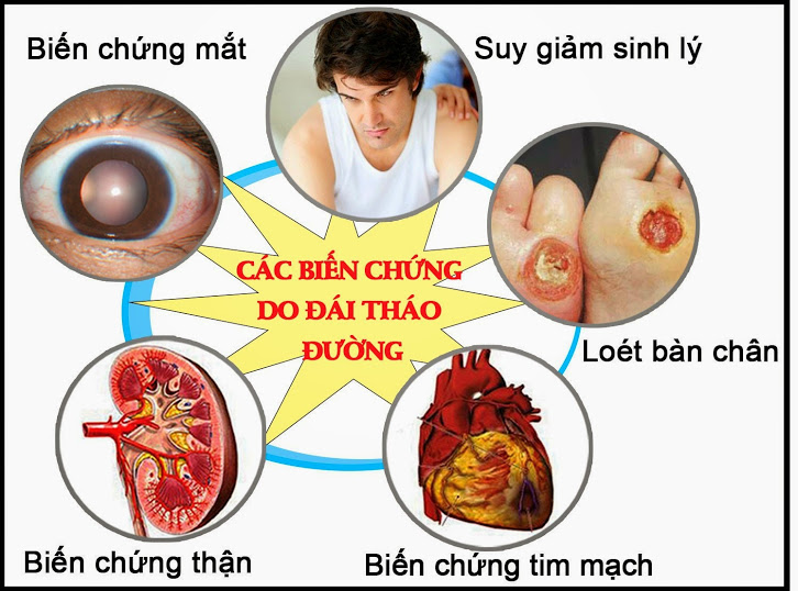 Bệnh tiểu đường và các biến chứng bệnh tiểu đường