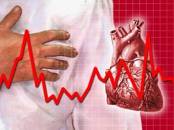 Bệnh tim mạch cũng là nguyên nhân gây tai biến mạch máu não