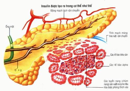 Bệnh tiểu đường là gì