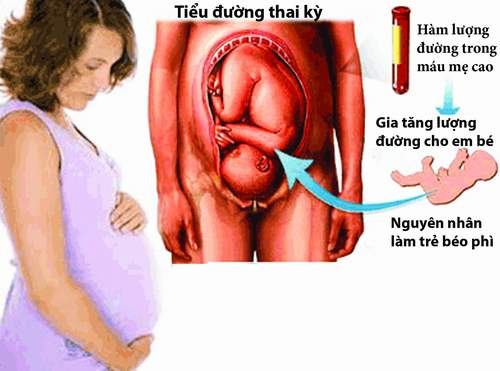 Ảnh hưởng của tiểu đường khi mang thai