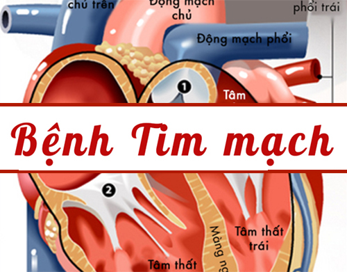 Nguyên nhân gây các bệnh về tim mạch 