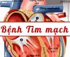 Nguyên nhân gây các bệnh về tim mạch