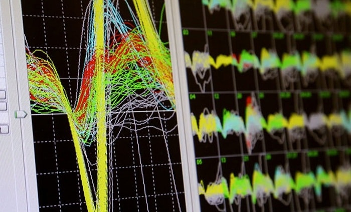 Ứng dụng công nghệ nhận biết sóng não để điều khiển xe lăn